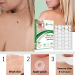 Get rid of skin tags and moles with skin tag removal patches