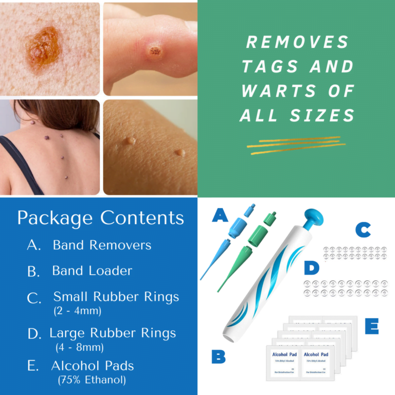 skin tag remover kit package contents