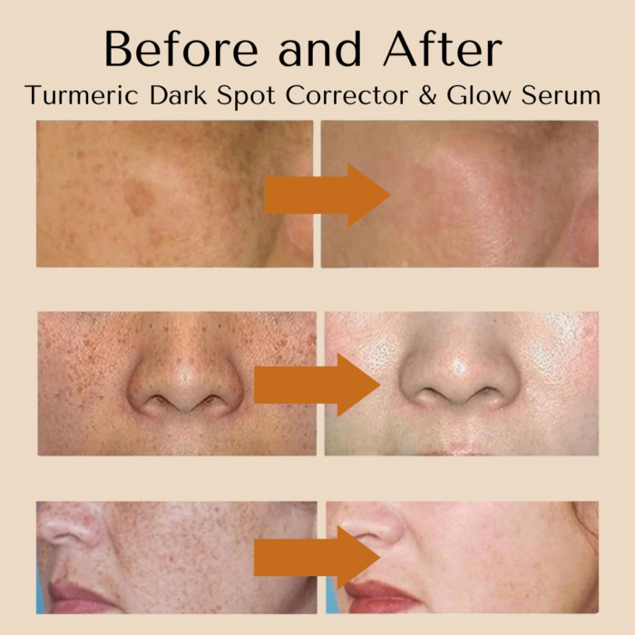 turmeric dark spot corrector and glow serum before and after