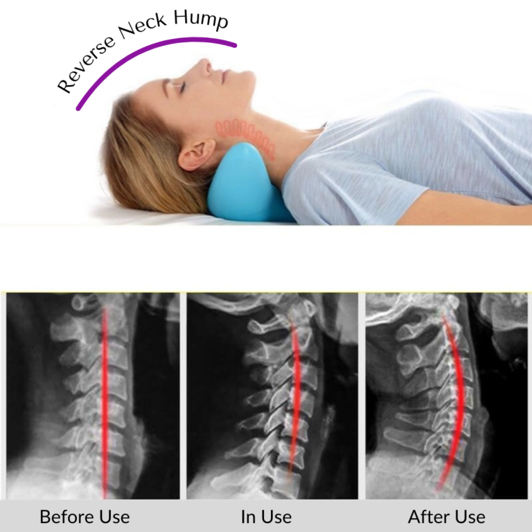 Cervical Spine Neck Massager Pillow- benefits reverse neck hump